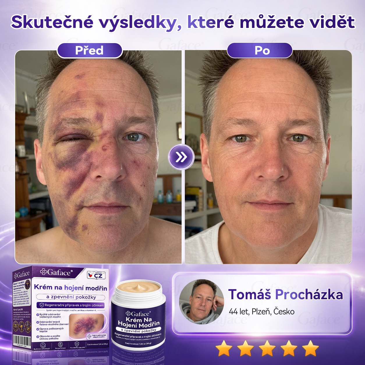 【𝑽í𝒄𝒆 𝒏𝒆ž 110 𝒕𝒊𝒔í𝒄 𝒑𝒓𝒐𝒅𝒂𝒏ý𝒄𝒉!】🚢 𝑮𝒂𝒇𝒂𝒄𝒆® 𝑲𝒓é𝒎 𝒏𝒂 𝒐𝒃𝒏𝒐𝒗𝒖 𝒑𝒐𝒌𝒐ž𝒌𝒚 𝒑𝒐 𝒎𝒐𝒅ř𝒊𝒏á𝒄𝒉 𝒂 𝒑𝒐𝒔í𝒍𝒆𝒏í 𝒑𝒐𝒌𝒐ž𝒌𝒚✨