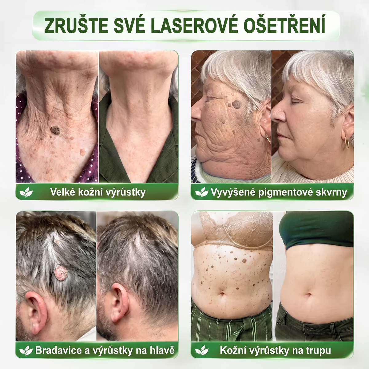 𝑯𝒆𝒂𝒍𝒓𝒊𝒛𝒆®🧬𝑷𝑫𝑹𝑵 𝒕𝒚č𝒊𝒏𝒌𝒂 𝒑𝒓𝒐𝒕𝒊 𝒔𝒕á𝒓𝒏𝒖𝒕í 𝒂 𝒄í𝒍𝒆𝒏á 𝒐𝒃𝒏𝒐𝒗𝒐𝒗𝒂𝒄í 𝒂𝒌𝒄𝒆 (𝒑𝒐𝒎á𝒉á 𝒗𝒚𝒉𝒍𝒂𝒛𝒐𝒗𝒂𝒕 𝒗𝒓á𝒔𝒌𝒚, 𝒑𝒐𝒅𝒑𝒐𝒓𝒖𝒋𝒆 𝒑𝒆𝒗𝒏ě𝒋ší 𝒑𝒍𝒆ť 𝒂 𝒛𝒍𝒆𝒑š𝒖𝒋𝒆 𝒗𝒛𝒉𝒍𝒆𝒅 𝒗𝒊𝒅𝒊𝒕𝒆𝒍𝒏ý𝒄𝒉 𝒔𝒌𝒗𝒓𝒏)