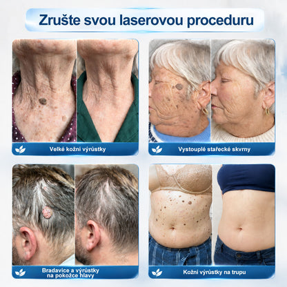 ✅️Oficiální značkový obchod |👩‍⚕️𝐏𝐢𝒄𝒅𝒐® 7 dní Odstraňovač kožních skvrn a kožních výrůstků(Bezbolestný rollerball bez jizev)🌳