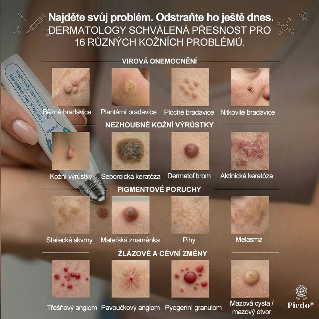 ✅️Oficiální značkový obchod |👩‍⚕️𝐏𝐢𝒄𝒅𝒐® 7 dní Odstraňovač kožních skvrn a kožních výrůstků(Bezbolestný rollerball bez jizev)🌳
